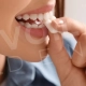 The Bonding Diet: What to Eat (and Avoid) for a Flawless Smile - Voiladent Dental Clinic