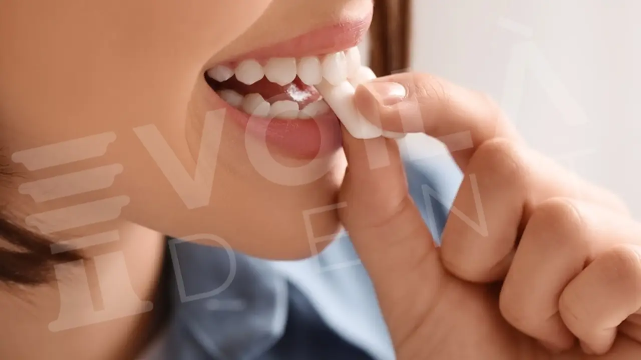 The Bonding Diet: What to Eat (and Avoid) for a Flawless Smile The Bonding Diet: What to Eat (and Avoid) for a Flawless Smile - Voiladent Dental Clinic