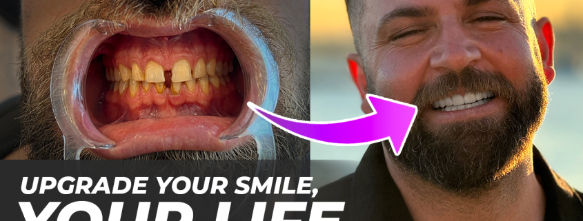 imperfect smile impact
