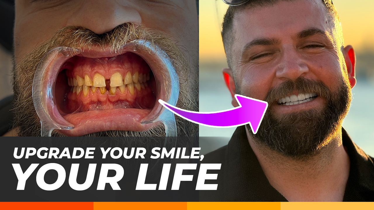 imperfect smile impact imperfect smile impact